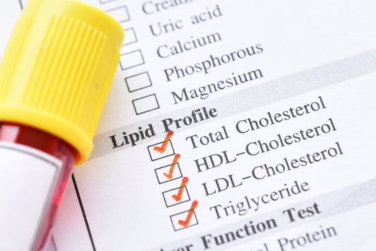 Having a cholesterol blood test how to prepare