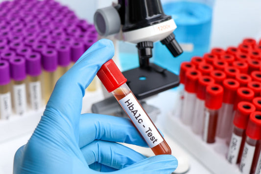 HbA1c Test: