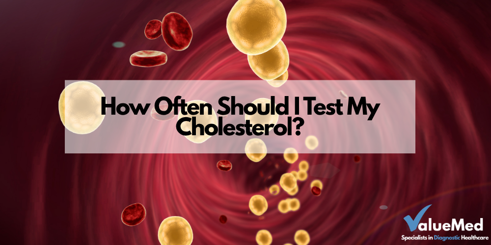 how often should you test if you have high cholesterol