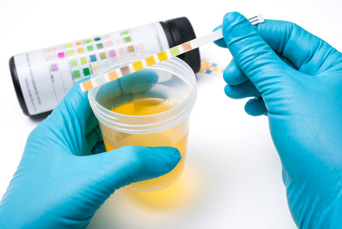 What Can Be Detected In A Urine Test