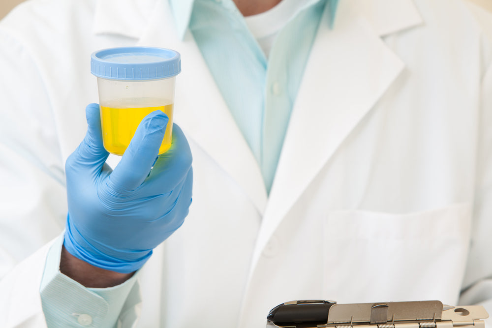 When doctors take a urine sample do they check for drugs