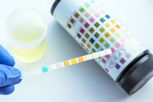 urine testing strips 10 parameter